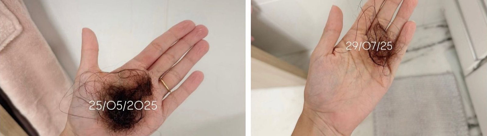 Cabelo caído no banho em maio e em julho de 2025, com redução visível do volume