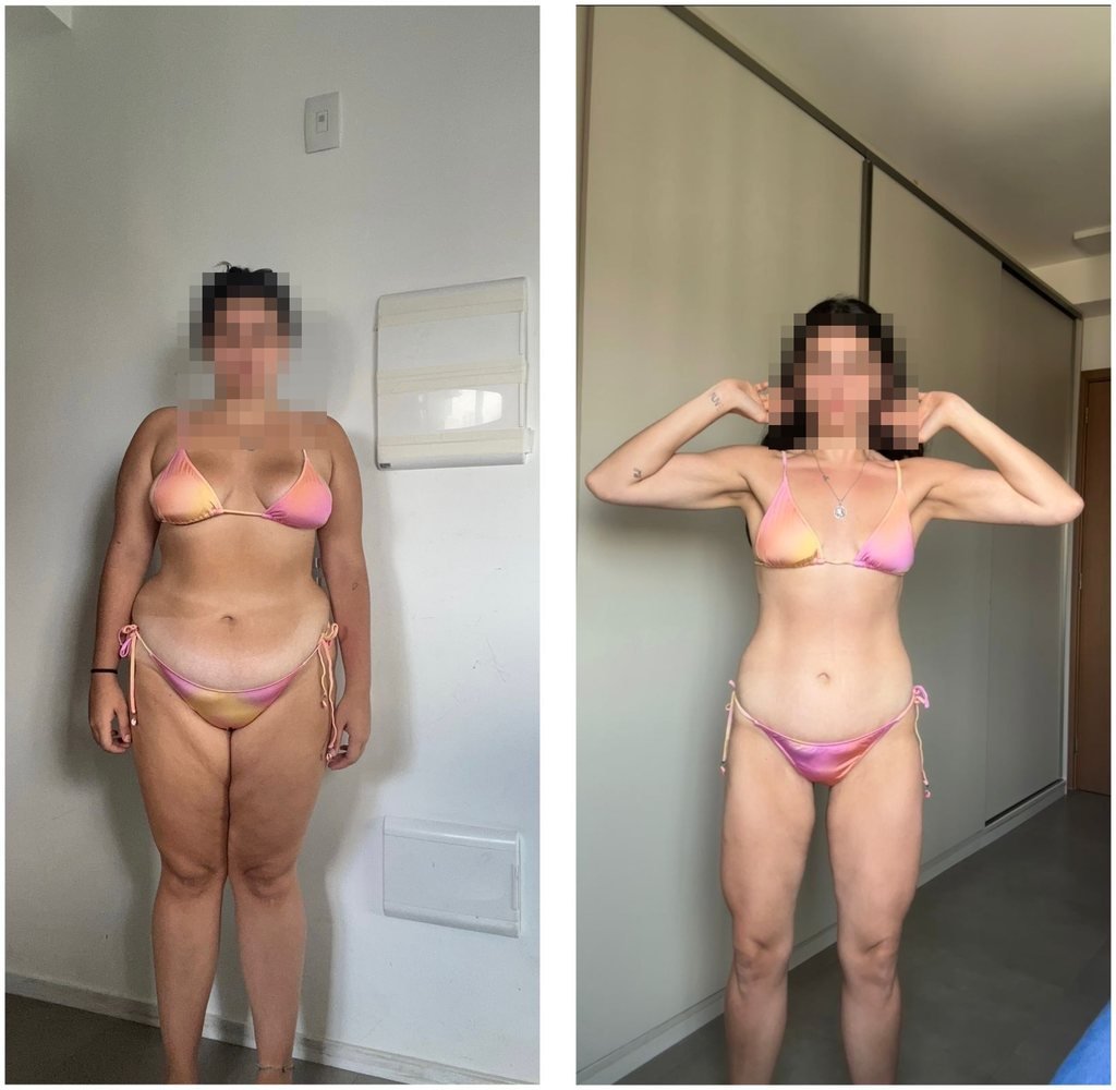 Comparação de composição corporal de paciente, antes à esquerda e depois à direita